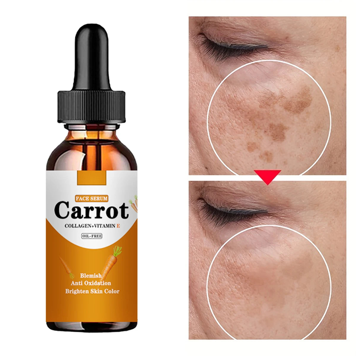 New Carrot Essence Essential oils Dark Spot Corrector Face Whitening Serum Brighten Blemish Freckle Remover 100% Natural